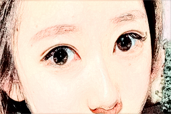 2024?？谑腥嗣襻t(yī)院飛秒手術(shù)價格?飛秒手術(shù)后注意事項(xiàng)