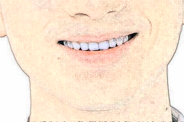 株洲市中心醫(yī)院牙科怎么樣?2024牙科收費(fèi)價(jià)格怎么樣