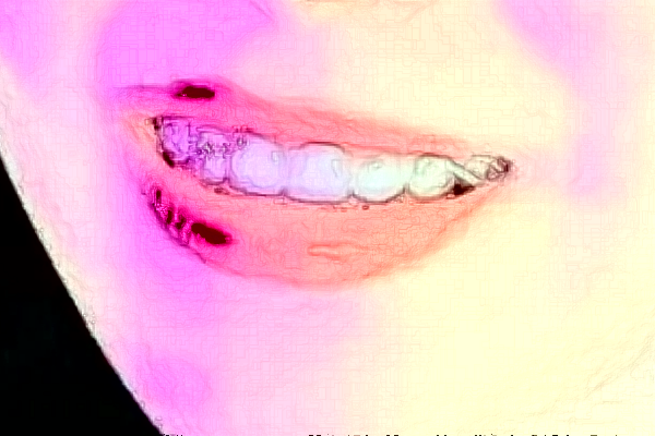 株洲市中心醫(yī)院補(bǔ)牙哪個(gè)醫(yī)生好些?2024全麻補(bǔ)牙費(fèi)用