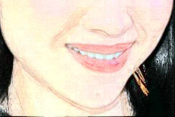 ?？谑腥嗣襻t(yī)院口腔科怎么樣?牙齒矯正好不好