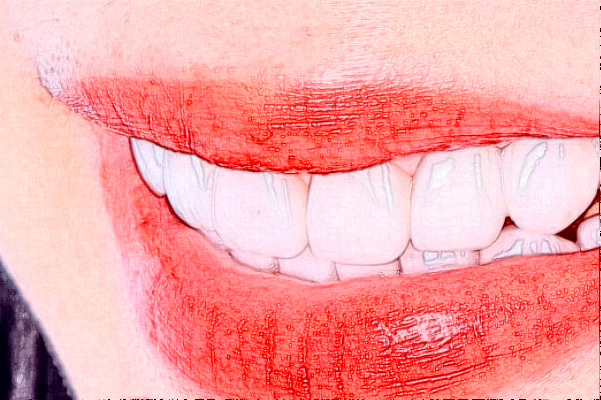 長沙科爾雅口腔醫(yī)院瓷貼面好的醫(yī)生推薦_美容日記展示