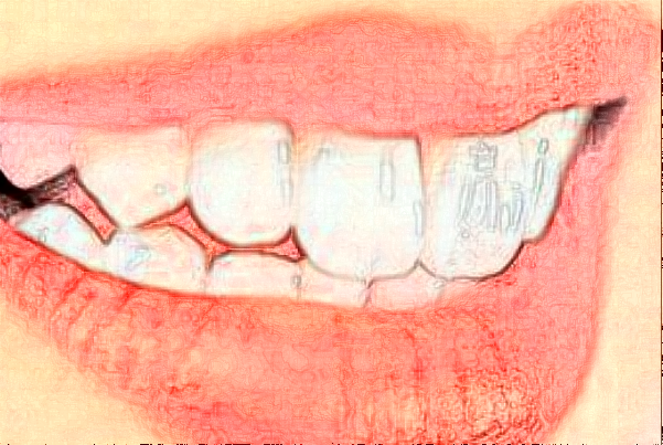 天津南開(kāi)醫(yī)院拔智齒怎么樣_整形日記分享