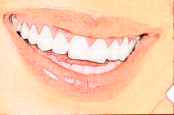 2024天津南開醫(yī)院烤瓷冠怎么樣|醫(yī)生介紹|價格收費