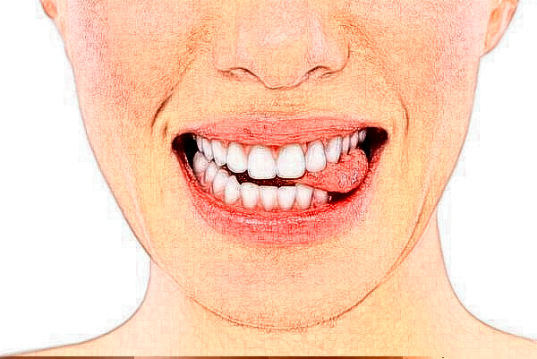 2024天津醫(yī)科大學總醫(yī)院口腔科冷光美白做的好嗎?整形日記分享