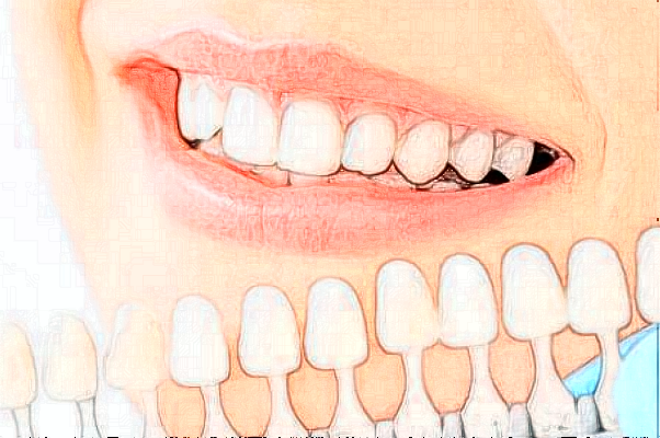 2024遼寧省人民醫(yī)院拔牙怎么樣|醫(yī)生介紹|價(jià)格收費(fèi)