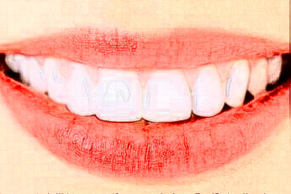 2024銅陵市人民醫(yī)院補(bǔ)牙怎么樣_案例分享