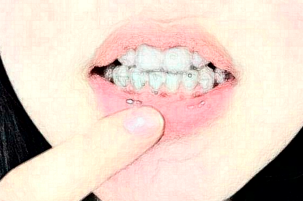 齊齊哈爾市中醫(yī)院正畸怎么樣_誰做得好