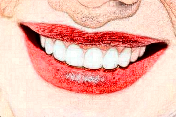 襄陽新德恩口腔門診部正畸費用多少_真實案例反饋