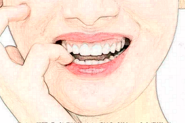 上海華美醫(yī)療美容醫(yī)院拔智齒好嗎_真實(shí)案例發(fā)布