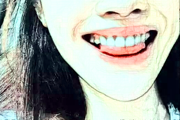 成都新橋口腔醫(yī)院根管疼嗎?根管的注意事項