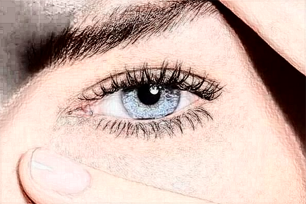 2024煙臺中醫(yī)院祛斑多少錢?激光祛斑怎么樣