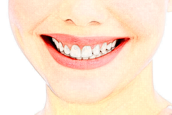 無錫市人民醫(yī)院地包天矯正價(jià)位多少?專家介紹