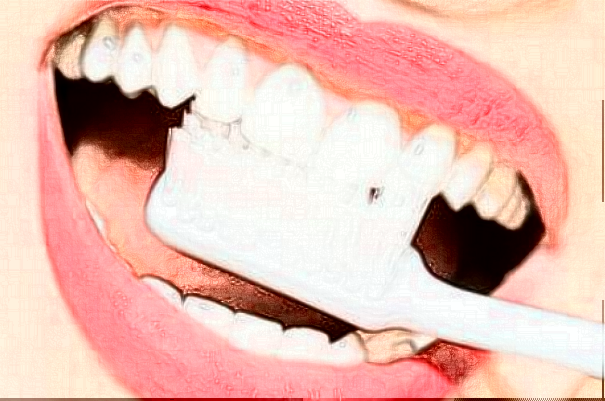 銅陵市人民醫(yī)院地包天矯正價位多少?專家介紹