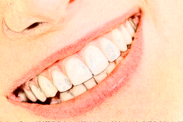 2024河北大學(xué)附屬醫(yī)院牙科醫(yī)生那個(gè)好_醫(yī)生排名