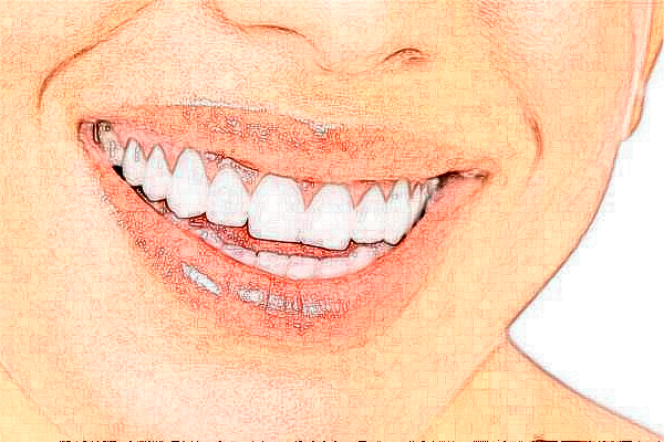 徐州醫(yī)科大學附屬醫(yī)院牙頜畸形矯正做的好嗎?哪位醫(yī)生做得好