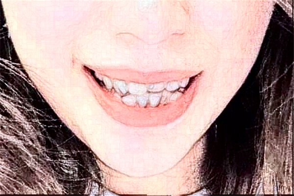 2024鎮(zhèn)江江濱醫(yī)院種牙貴嗎?那個醫(yī)生技術比較好