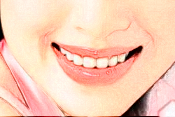 2024成都新橋口腔醫(yī)院拔智齒多少錢?拔智齒要多久恢復(fù)