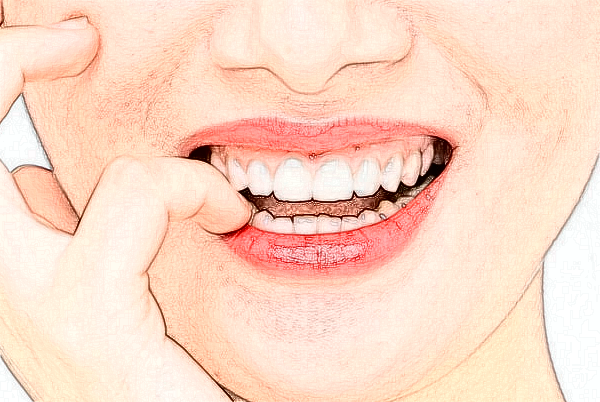 2024山西省人民醫(yī)院地包天矯正價目表(價格表)_口碑怎么樣