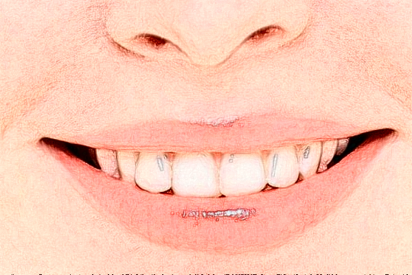 鄭州植得口腔醫(yī)院正畸醫(yī)生好不好?2024正畸醫(yī)生收費(fèi)價(jià)格