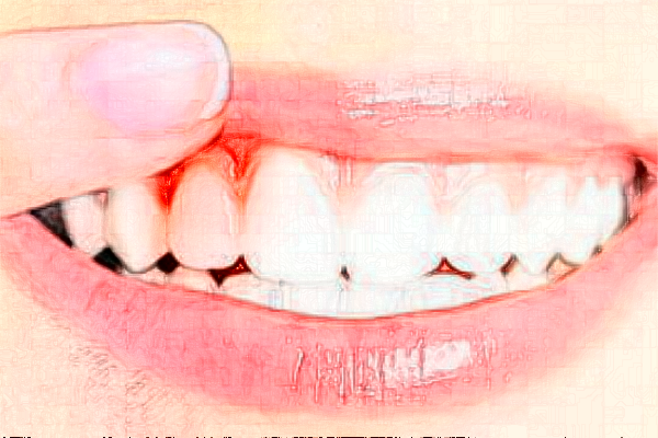 鄭州植得口腔醫(yī)院正畸醫(yī)生好不好?2024正畸醫(yī)生收費(fèi)價(jià)格