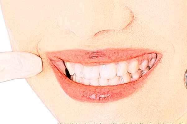 2024齊齊哈爾市中醫(yī)院瓷貼面費(fèi)用多少_真實(shí)案例反饋