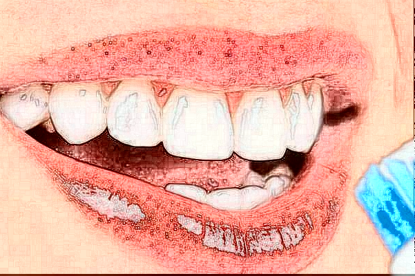 福州福能海峽口腔醫(yī)院舌側(cè)矯正怎么樣_醫(yī)生排名介紹