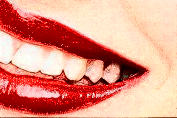 成都茁悅口腔正畸做的好嗎?哪位醫(yī)生做得好