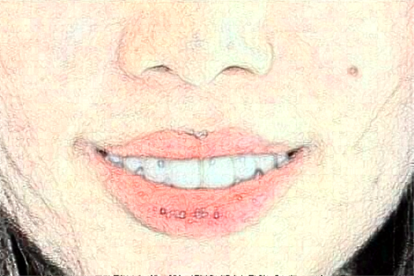 北京牙管家口腔診所補牙怎么樣|醫(yī)生介紹|價格收費