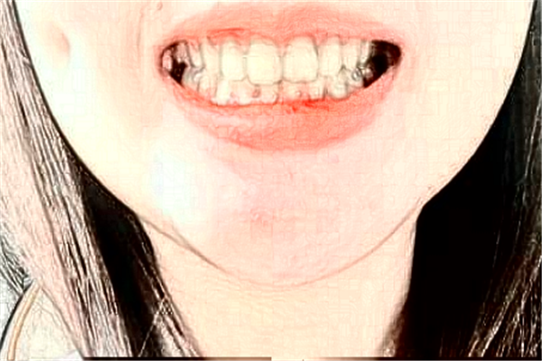 2024重慶齊美口腔門診部補(bǔ)牙怎么樣_專家信息_案例大全欣賞