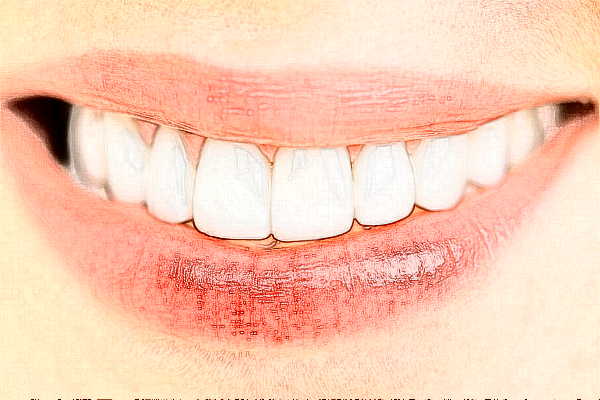 成都新橋口腔醫(yī)院拔牙沒拔干凈怎么辦?拔牙醫(yī)生好嗎?