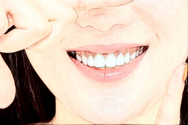 2024山東鉑爾口腔全瓷牙哪個醫(yī)生好?專家名單+案例反饋