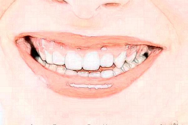 成都茁悅口腔噴砂洗牙好的醫(yī)生推薦_美容日記展示