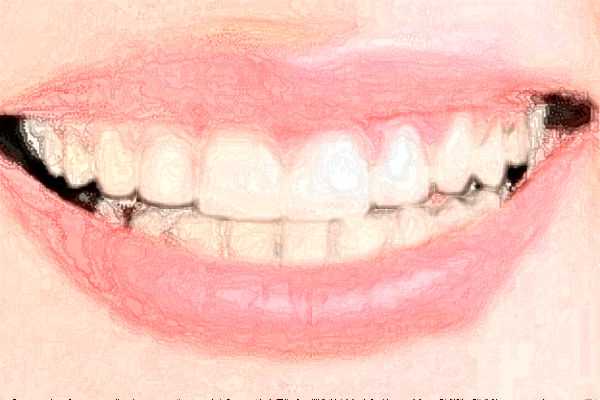 北京牙管家口腔診所全瓷牙怎么樣|醫(yī)生介紹|價格收費