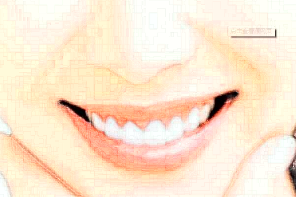 2024福州美橙口腔全瓷冠好不好?附術(shù)后案例參考!