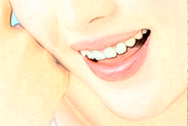 襄陽新德恩口腔門診部全口牙種植怎么樣_誰做得好