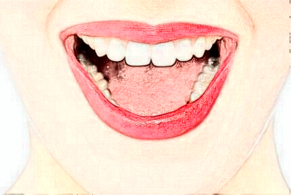 天津南開(kāi)醫(yī)院前牙種植費(fèi)用多少_醫(yī)生名單