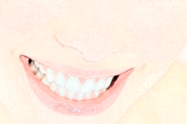 天津南開(kāi)醫(yī)院前牙種植費(fèi)用多少_醫(yī)生名單