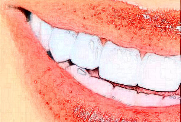 長沙科爾雅口腔醫(yī)院單牙種植價(jià)格多少?整形日記全過程分享