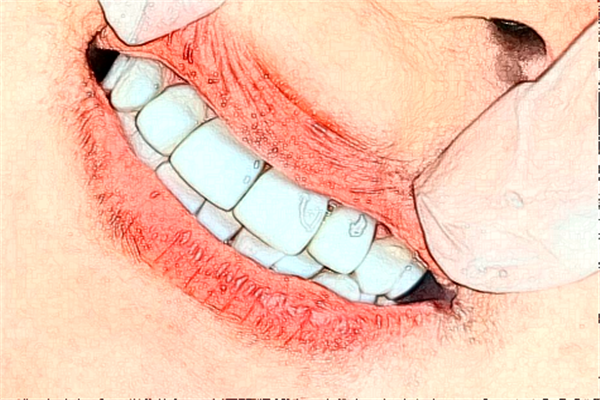 2024太原眾牙口腔醫(yī)院補(bǔ)牙多少錢(qián)?做的怎么樣