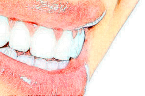 2024杭州雅萊口腔鑲牙好嗎|專家醫(yī)生|案例分享