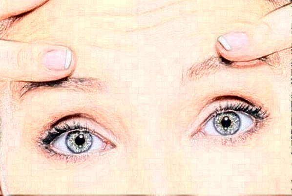 2024遼寧省人民醫(yī)院全飛秒費用多少?整形日記全過程