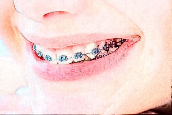 2024山東鉑爾口腔全口種植哪個(gè)醫(yī)生好?專家名單+案例反饋