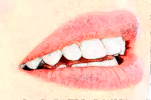 成都新橋口腔醫(yī)院種植醫(yī)生王旭東好嗎?2024種植牙價格