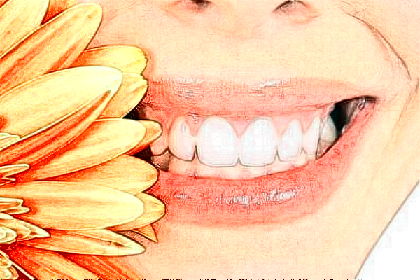 宣城大醫(yī)醫(yī)院種植牙的特點(diǎn)?種植牙的種植體系