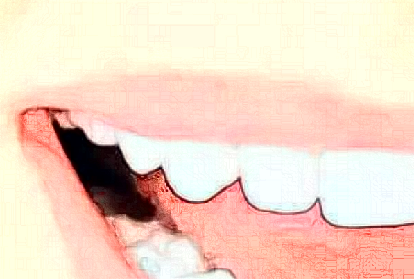 貴陽柏德口腔醫(yī)院烤瓷牙怎么樣|醫(yī)生介紹|價格收費(fèi)