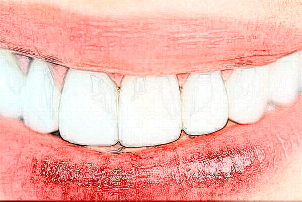 長(zhǎng)沙科爾雅口腔醫(yī)院補(bǔ)牙做的好嗎?哪位醫(yī)生做得好