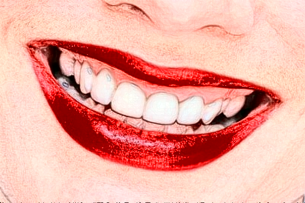 鄭州唯美口腔醫(yī)院美容冠價(jià)格多少?整形日記全過程分享