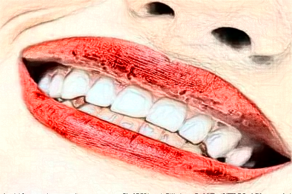 2024福州福能海峽口腔醫(yī)院瓷貼面貴不貴?案例緊跟一覽!