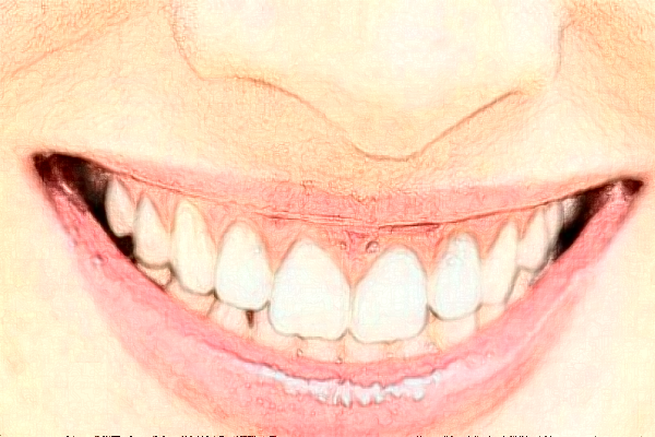 2024蘇州姑蘇美奧口腔金屬矯正怎么樣_誰做得好