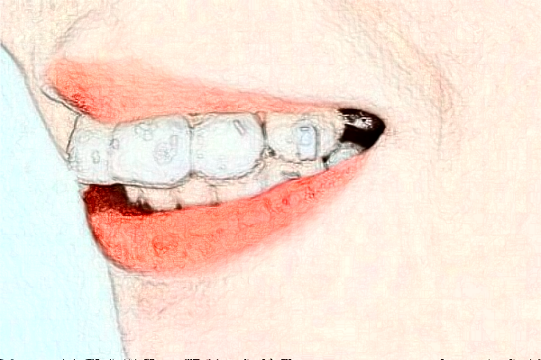 2024成都茁悅口腔超聲波洗牙好的醫(yī)生推薦_美容日記展示